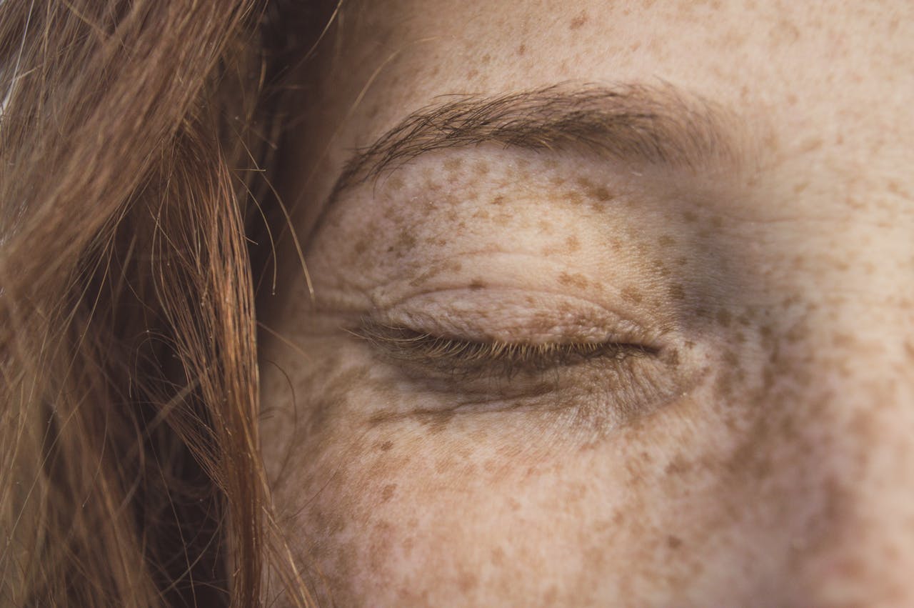 Detailed close-up of a person's freckled skin with eye closed, highlighting texture and color.