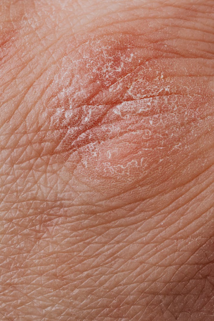 Detailed image highlighting dry, flaky skin texture for dermatological study.